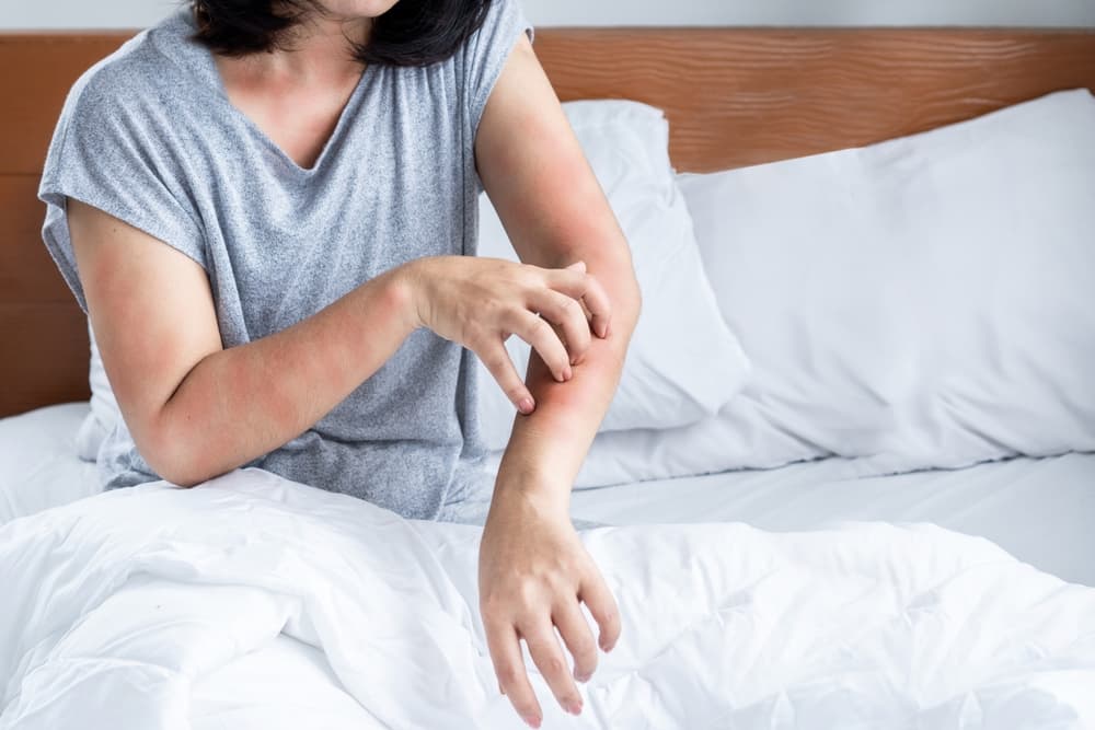 ベッドの中で腕を掻いている女性